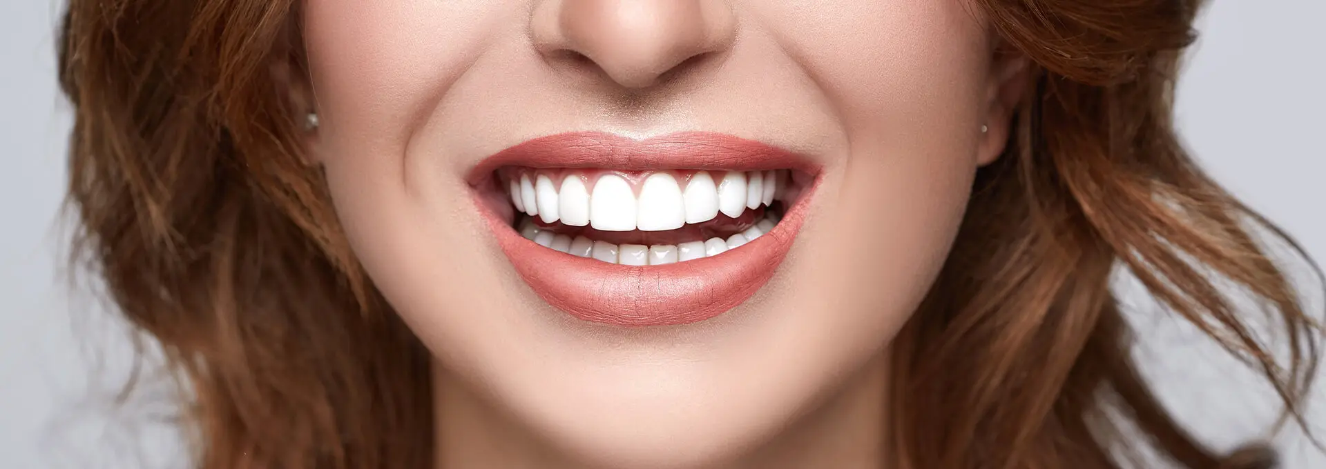 Dental Veneers in Alvin, Texas