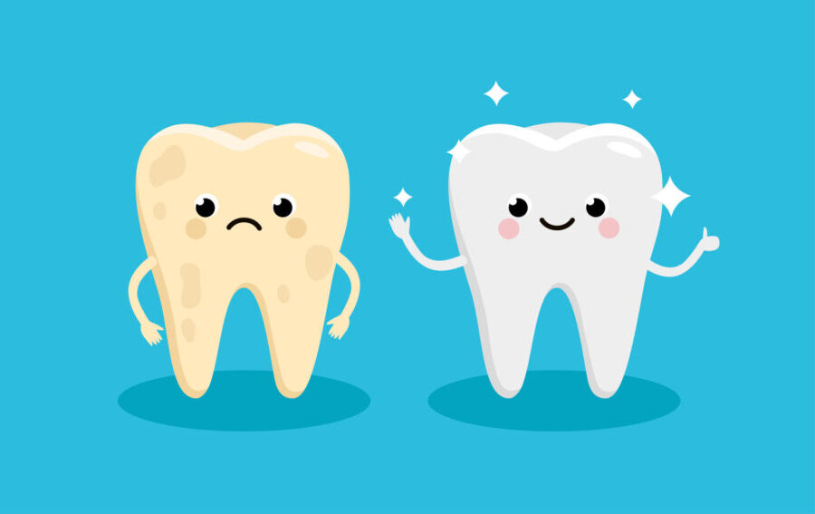 Illustration of a sad yellow tooth next to a happy white tooth