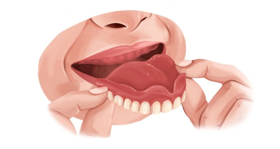 Illustration of a woman taking out her dentures