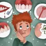 reasons for dental implant failure