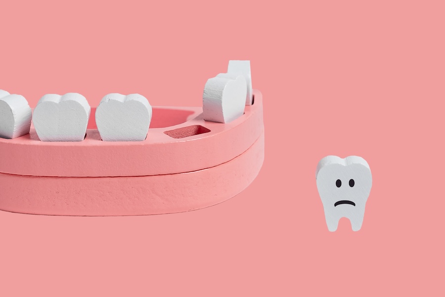 knocked out tooth, dental emergency
